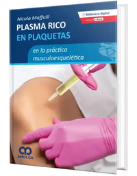 Plasma Rico en Plaquetas en la Práctica musculoesquelética