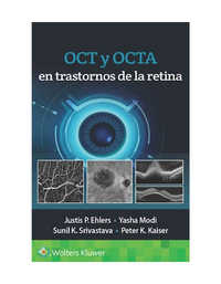 OCT y OCTA en trastornos de la retina es una referencia concisa y confiable para conocer e interpretar los fundamentos de aplicación y los hallazgos más representativos de la tomografía de coherencia óptica (OCT) y de la angiografía OCT (OCTA) en padecimientos frecuentes y no frecuentes de la retina y del segmento posterior del ojo. Cada uno de sus capítulos explora las características de pronóstico de la OCT y de las exploraciones OCTA junto con las modalidades de diagnóstico adicionales para comparación y correlación. Este manual incluye una gran variedad de ejemplos de OCT y de OCTA representativos de cada etapa de enfermedad, resalta los factores de pronóstico por OCT y muestra las respuestas a la terapia cuando corresponde. También incluye, de manera breve y digerible, una síntesis de las características de imagen más recientemente descritas en cada estado de enfermedad.