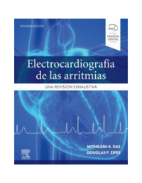Electrocardiografía de las arritmias 2 edition