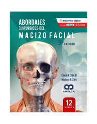 Abordajes Quirúrgicos del Macizo Facial. 3a Edición