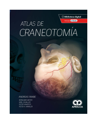 Atlas de Craneotomía
